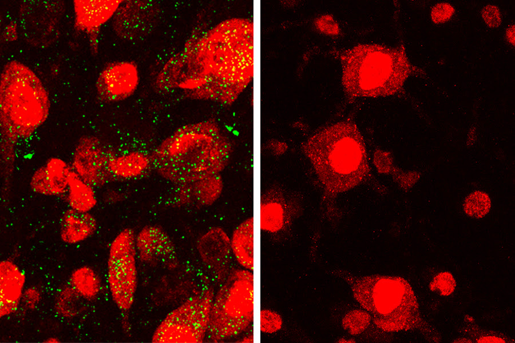 In the confocal microscope image on the left, GALC enzyme (green) is expressed in neurons (red) in the normal mouse brain. In the image on the right, GALC enzyme is absent in the neurons of the Krabbe mouse brain. (Image: Daesung Shin; courtesy of the University at Buffalo)