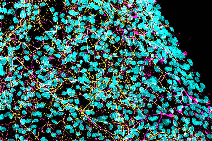 This image shows axons in vitro 24 hours after injury. The presence of Schwann cells (nuclei in cyan) helped maintain the integrity of axons (in magenta and yellow). (Image credit: Elisabetta Babetto, HJKRI)